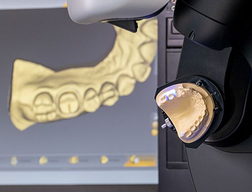 Equipo CAD/CAM que es un moderno escáner dental de laboratorio extraoral.