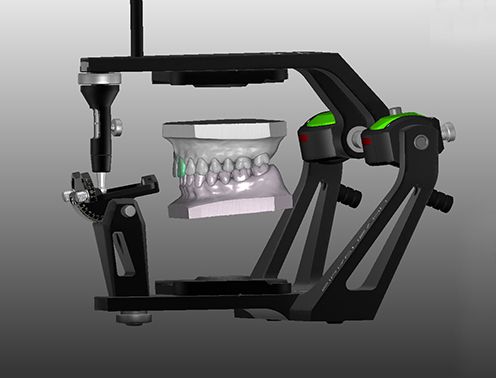 Imagen de como trabaja en un ordenador, la tecnología cad/cam, con una dentadura justo en medio.